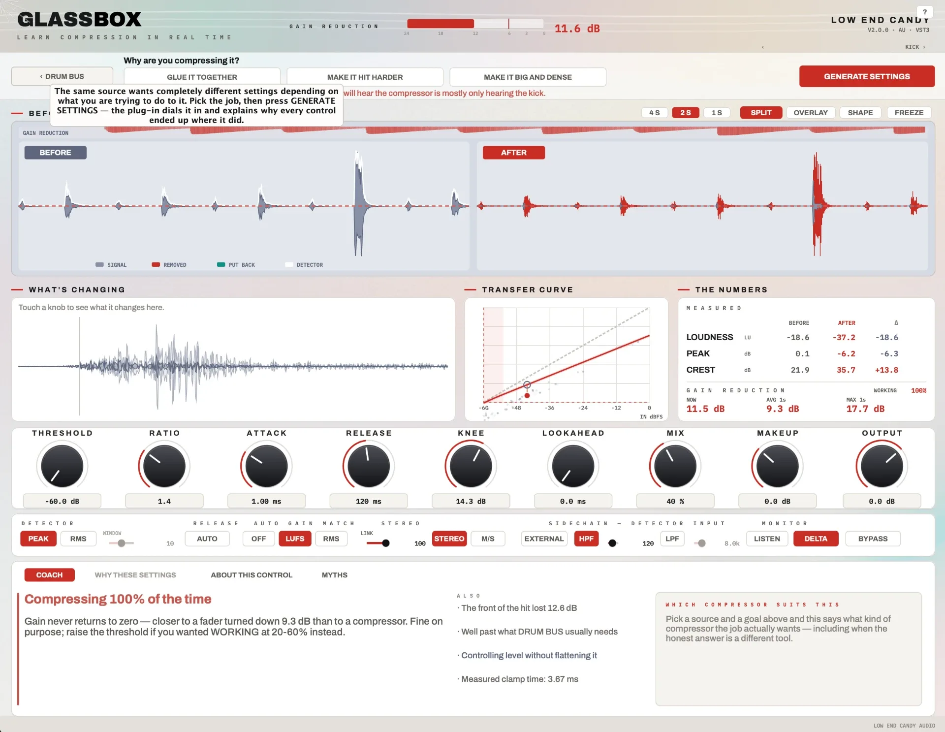 Glassbox compressor interface — split before/after waveforms, transfer curve, measured loudness numbers and the coaching panel